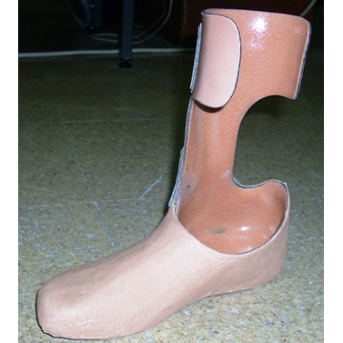  Prosthesis for Partial Foot Amputation
