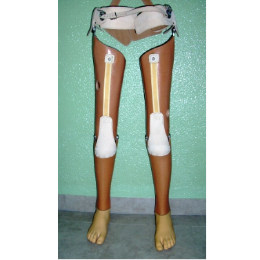 Exoskeletal Transfemural Prosthesis with Hip Joints and Pelvic Band