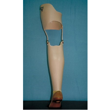  Transtibial Prosthesis with External Knee Joints, Ischial ring and SACH foot